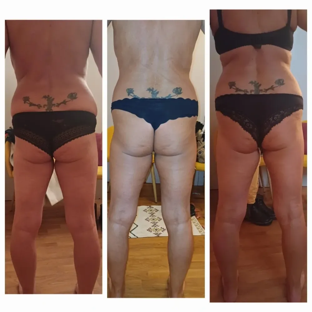 Remodelage de la silhouette