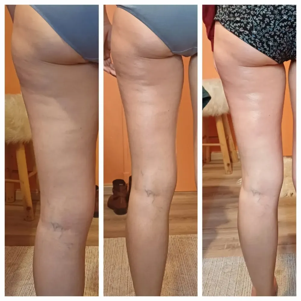 Des cuisses raffermies